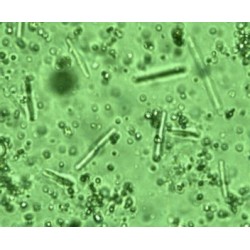 Análisis de Megabacterias 